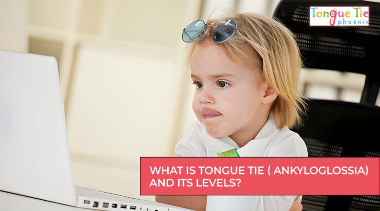 Tongue Tie Levels - tongue tie phoenix