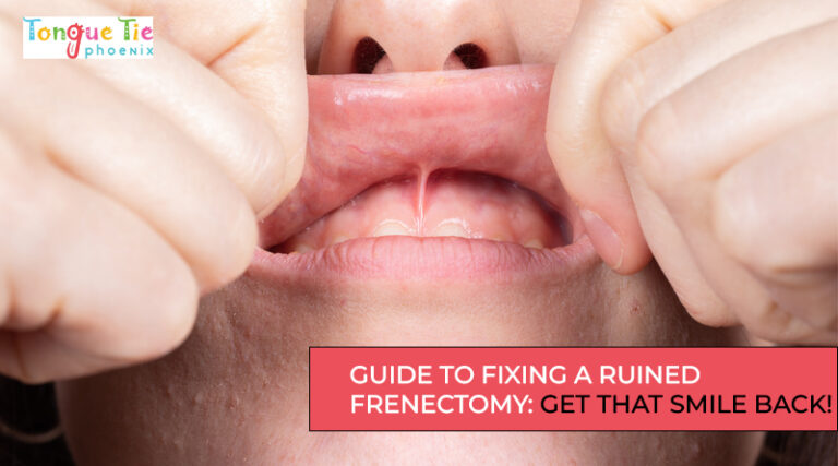 Doctor examining the upper lip frenulum to see if a frenectomy is necessary, a procedure that some feel affected their smile