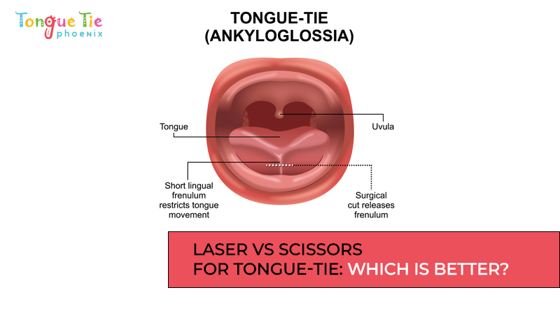 Scissors And Ronguers Testing Tongue Tie Test: Signs, Diagnosis, and 7 Steps for Assessment