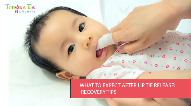 Pediatric dentist performing a laser lip tie release on an infant