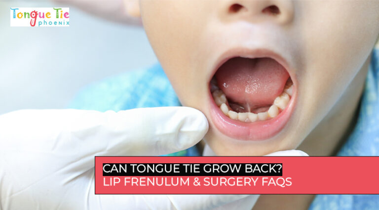 Can tongue tie grow back? Doctor examines child’s tongue and dental health